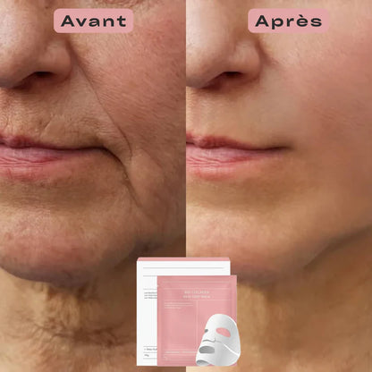 NovaPro® Éclat PDRN Collagène Masque