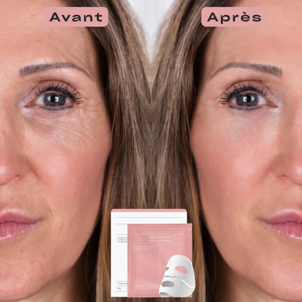 2. résultats comparables au botox, sans risques